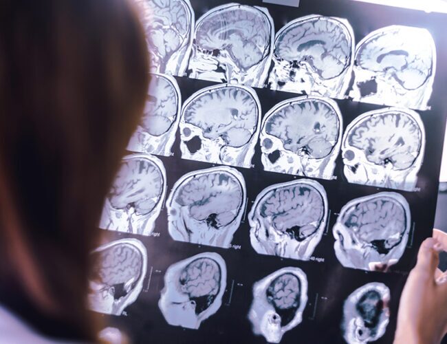 Doctor looking at brain scans