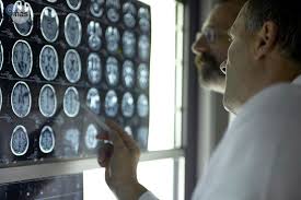 Doctors studying memory loss in brain images